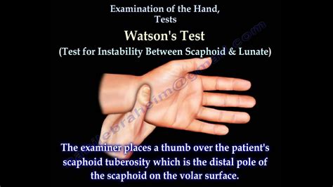 EVALUATION OF HAND